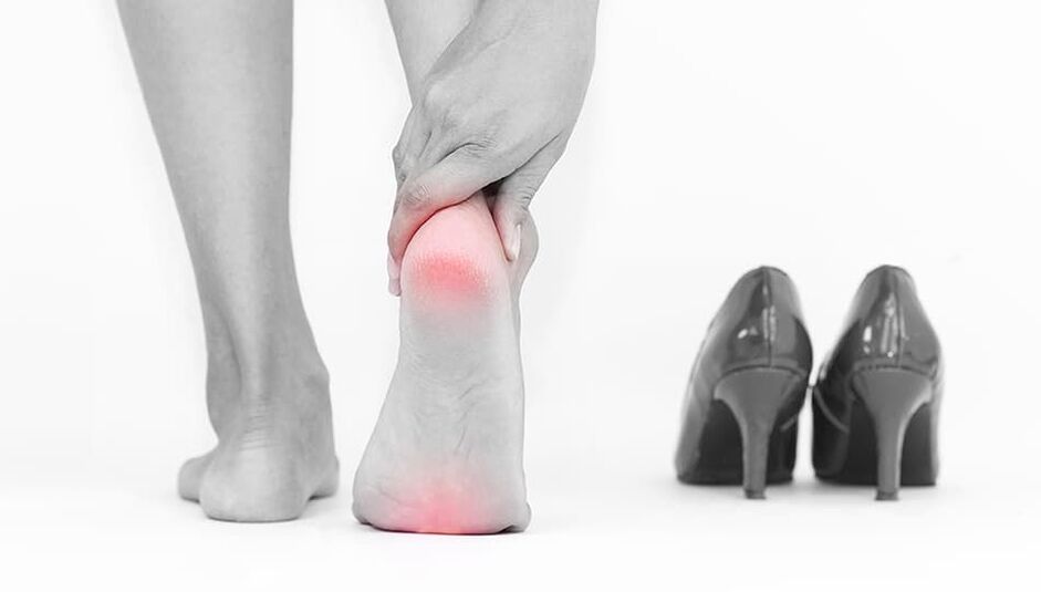 Das Tragen enger Schuhe ist die Ursache für Mykose
