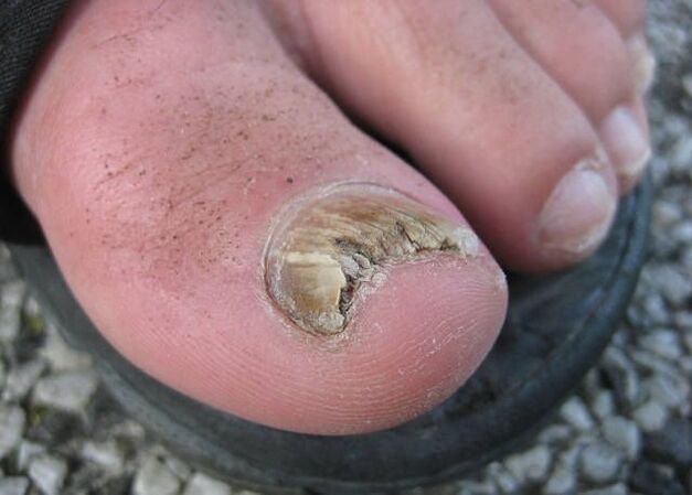 Das Ergebnis der Fahrlässigkeit