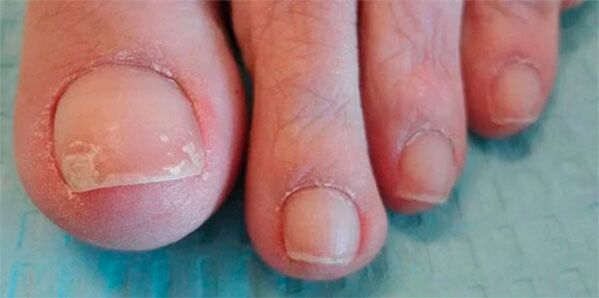 Phasen von Pilzbeinen