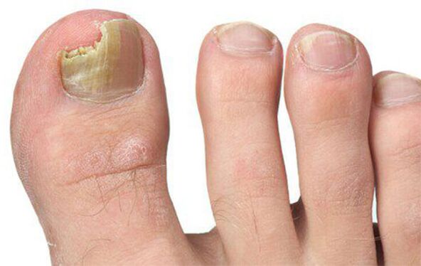 Verschiedene Formen von Pilzen