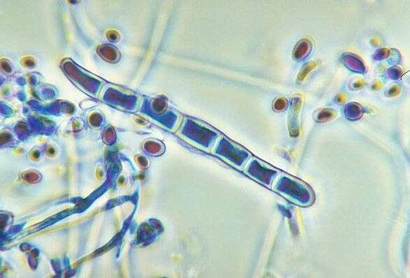 Trichophyton rubrum-Pilz unter dem Mikroskop